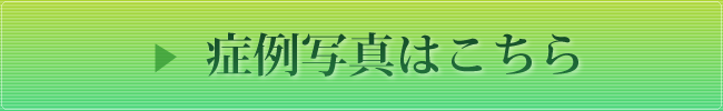 症例写真はこちら