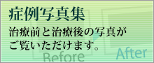 症例写真